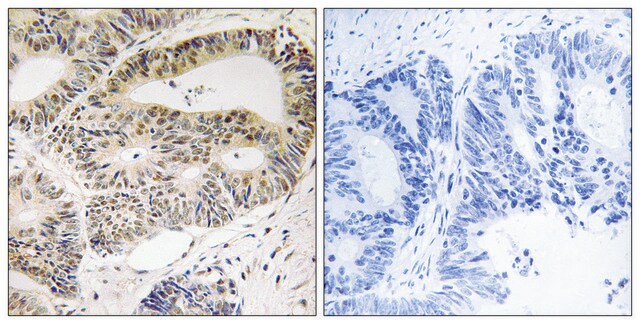 Anti-OSR1 antibody produced in rabbit affinity isolated antibody