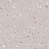 Anti-P2RY10 antibody produced in rabbit Prestige Antibodies&#174; Powered by Atlas Antibodies, affinity isolated antibody, buffered aqueous glycerol solution