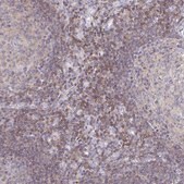 Anti-PIK3CD antibody produced in rabbit Prestige Antibodies&#174; Powered by Atlas Antibodies, affinity isolated antibody, buffered aqueous glycerol solution