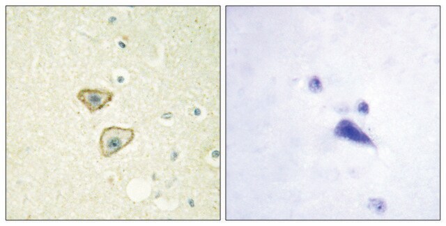 Anti-EGFR antibody produced in rabbit affinity isolated antibody