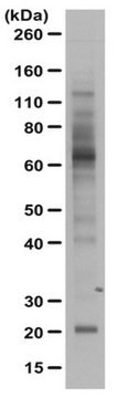 Anti-Zinc Fingers Linker (ZnFL) Antibody from rabbit, purified by affinity chromatography