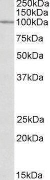 Anti-CLCN2 antibody produced in goat affinity isolated antibody, buffered aqueous solution