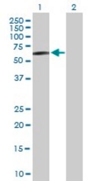 Anti-STK33 antibody produced in mouse purified immunoglobulin, buffered aqueous solution