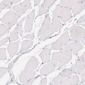 Anti-DDX17 antibody produced in rabbit Prestige Antibodies&#174; Powered by Atlas Antibodies, affinity isolated antibody, buffered aqueous glycerol solution