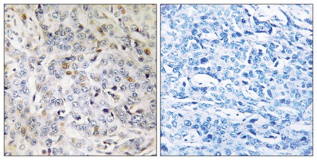 Anti-PDIK1L antibody produced in rabbit affinity isolated antibody