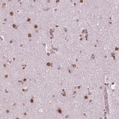 Monoclonal Anti-BRD4 antibody produced in mouse Prestige Antibodies&#174; Powered by Atlas Antibodies, clone CL1118, purified immunoglobulin, buffered aqueous glycerol solution