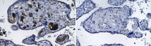 Anti-Fibrin Antibody, clone 59D8 ZooMAb&#174; Mouse Monoclonal recombinant, expressed in HEK 293 cells