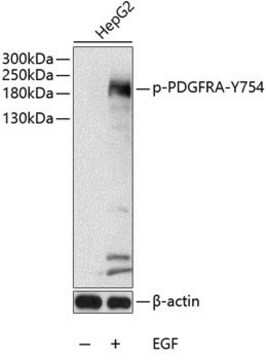 Anti-Phospho-PDGFRA-Y754 antibody produced in rabbit