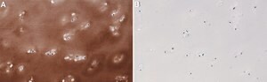 Anti-Collagen Type II Antibody, clone 1K11 ZooMAb&#174; Rabbit Monoclonal recombinant, expressed in HEK 293 cells