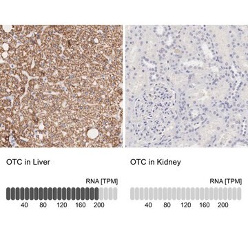 Anti-OTC antibody produced in rabbit Prestige Antibodies&#174; Powered by Atlas Antibodies, affinity isolated antibody, buffered aqueous glycerol solution