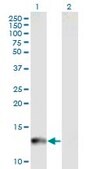 Monoclonal Anti-CYP24A1 antibody produced in mouse clone 1F8, purified immunoglobulin, buffered aqueous solution