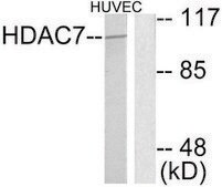 Anti-HDAC7 antibody produced in rabbit affinity isolated antibody