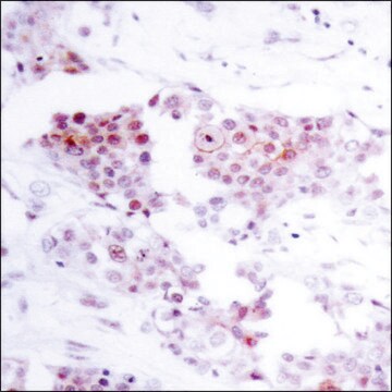 Anti-MEF2A (Ab-319) antibody produced in rabbit affinity isolated antibody