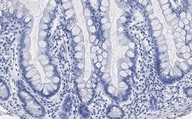 Anti-Caspase-7 Antibody, clone 1E21 ZooMAb&#174; Rabbit Monoclonal recombinant, expressed in HEK 293 cells