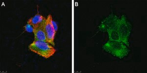 Anti-TRPA1 Antibody, clone 2N14 ZooMAb&#174; Rabbit Monoclonal recombinant, expressed in HEK 293 cells