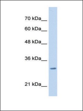 Anti-MLF2 (AB1) antibody produced in rabbit affinity isolated antibody