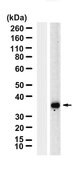 Anti-IL-1&#946; Antibody, clone 1H20-H2 ZooMAb&#174; Rabbit Monoclonal recombinant, expressed in HEK 293 cells