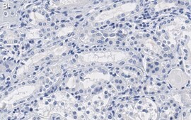 Anti-Na+/K+ ATPase &#945;-1 Antibody, clone C464.6 ZooMAb&#174; Mouse Monoclonal recombinant, expressed in HEK 293 cells
