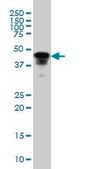 Monoclonal Anti-FOXA1 antibody produced in mouse clone 2D7, purified immunoglobulin, buffered aqueous solution