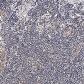 Anti-LAMB1 antibody produced in rabbit Prestige Antibodies&#174; Powered by Atlas Antibodies, affinity isolated antibody, buffered aqueous glycerol solution