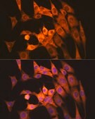 Anti-Calpain 1 Antibody, clone 10E6O5, Rabbit Monoclonal