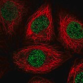 Anti-PSMA1 antibody produced in rabbit Prestige Antibodies&#174; Powered by Atlas Antibodies, affinity isolated antibody, buffered aqueous glycerol solution