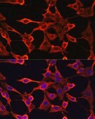 Anti-TYMS antibody produced in rabbit