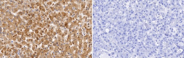 Anti-DGAT2 Antibody, clone 2H10 ZooMAb&#174; Rabbit Monoclonal recombinant, expressed in HEK 293 cells