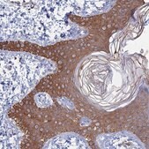 Anti-IL7 antibody produced in rabbit Prestige Antibodies&#174; Powered by Atlas Antibodies, affinity isolated antibody, buffered aqueous glycerol solution