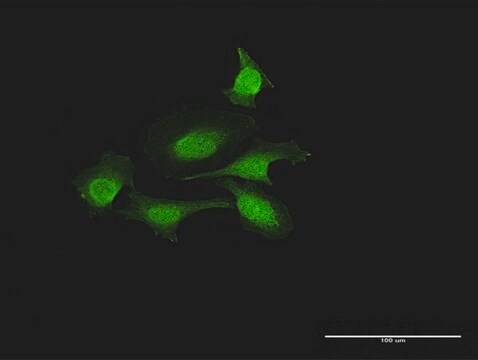 Anti-FOXJ2 antibody produced in rabbit purified immunoglobulin, buffered aqueous solution