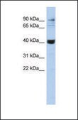 Anti-MMP3 antibody produced in rabbit affinity isolated antibody