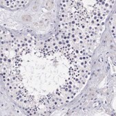 Anti-ARG2 antibody produced in rabbit affinity isolated antibody, buffered aqueous glycerol solution
