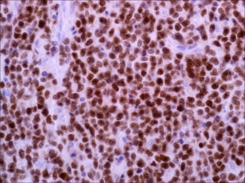 BCL6 (EP278) Rabbit Monoclonal Primary Antibody