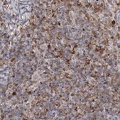Anti-STAT1 antibody produced in rabbit Ab2, Prestige Antibodies&#174; Powered by Atlas Antibodies, affinity isolated antibody, buffered aqueous glycerol solution