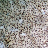 Anti-phospho-PTPRA (pTyr798) antibody produced in rabbit affinity isolated antibody