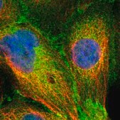 Anti-SLK antibody produced in rabbit Prestige Antibodies&#174; Powered by Atlas Antibodies, affinity isolated antibody, buffered aqueous glycerol solution