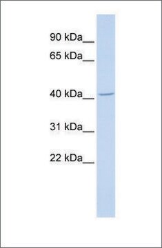 Anti-ALX4 antibody produced in rabbit affinity isolated antibody