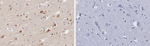 Anti-JNK2 Antibody, clone 1F16 ZooMAb&#174; Rabbit Monoclonal recombinant, expressed in HEK 293 cells