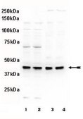 Anti-phospho-MEK1 (Thr292) Antibody Upstate&#174;, from rabbit