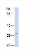 Anti-SDHB antibody produced in rabbit affinity isolated antibody