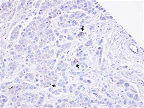 Anti-TRPM2 (N-terminal) antibody produced in rabbit affinity isolated antibody, buffered aqueous solution