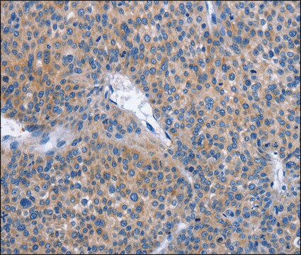 Anti-IBSP antibody produced in rabbit affinity isolated antibody