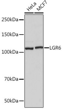 Anti-LGR6 Antibody, clone 8J2J10, Rabbit Monoclonal