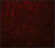 Anti-TRESK antibody produced in rabbit affinity isolated antibody, buffered aqueous solution