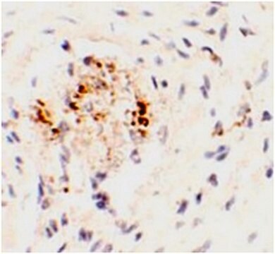 Anti-LEMD3 Antibody from rabbit, purified by affinity chromatography