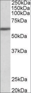 Anti-ZNF703 antibody produced in goat affinity isolated antibody, buffered aqueous solution