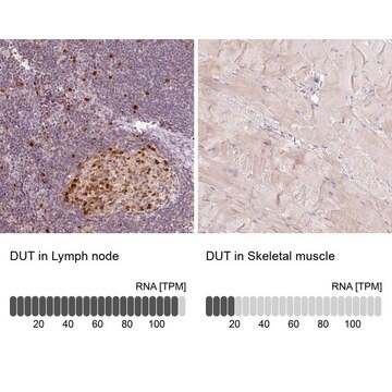 Anti-DUT antibody produced in rabbit Prestige Antibodies&#174; Powered by Atlas Antibodies, affinity isolated antibody, buffered aqueous glycerol solution