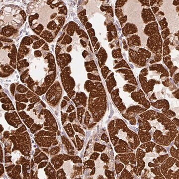 Anti-MFSD9 antibody produced in rabbit Prestige Antibodies&#174; Powered by Atlas Antibodies, affinity isolated antibody, buffered aqueous glycerol solution