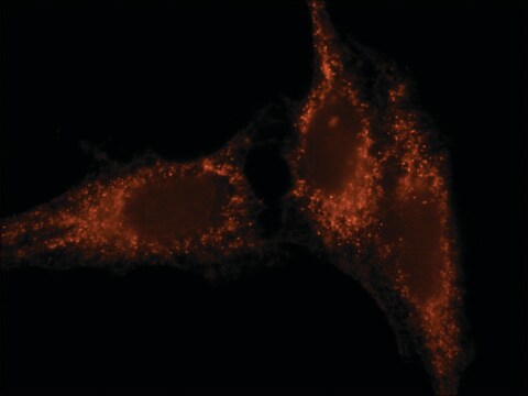 Anti-Rab27 (N-terminal) antibody produced in rabbit ~1.5&#160;mg/mL, affinity isolated antibody, buffered aqueous solution