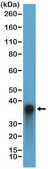 Anti-Arginase-1 (ARG1) antibody, Rabbit monoclonal recombinant, expressed in HEK 293 cells, clone RM377, purified immunoglobulin